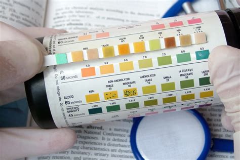 torn seal on urinalysis test|how to interpret urinalysis results.